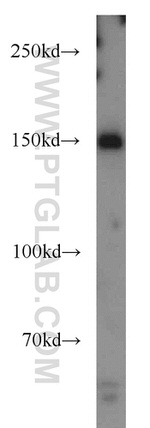 ANKRD11 Antibody in Western Blot (WB)