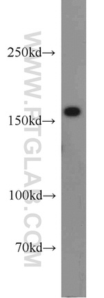 ANKRD11 Antibody in Western Blot (WB)