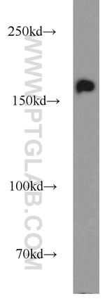 ANKRD11 Antibody in Western Blot (WB)