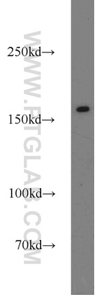 ANKRD11 Antibody in Western Blot (WB)