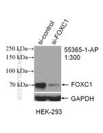 FOXC1 Antibody in Western Blot (WB)