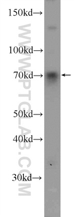FOXC1 Antibody in Western Blot (WB)