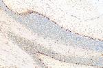 SKOR2 Antibody in Immunohistochemistry (Paraffin) (IHC (P))