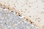SKOR2 Antibody in Immunohistochemistry (Paraffin) (IHC (P))