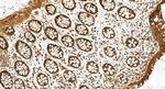 CAPN13 Antibody in Immunohistochemistry (Paraffin) (IHC (P))
