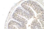 CAPN13 Antibody in Immunohistochemistry (Paraffin) (IHC (P))
