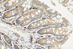 CAPN13 Antibody in Immunohistochemistry (Paraffin) (IHC (P))