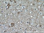 GJC2 Antibody in Immunohistochemistry (Paraffin) (IHC (P))