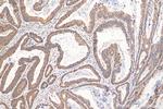 SETD2 Antibody in Immunohistochemistry (Paraffin) (IHC (P))
