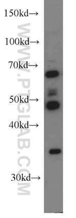 HLA-F Antibody in Western Blot (WB)