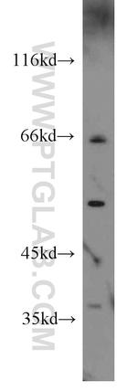 HLA-F Antibody in Western Blot (WB)