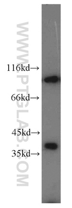 PYGB Antibody in Western Blot (WB)