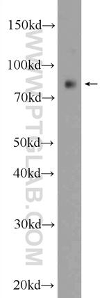PPP1R3F Antibody in Western Blot (WB)