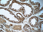 PKA C-alpha Antibody in Immunohistochemistry (Paraffin) (IHC (P))