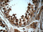 PKA C-alpha Antibody in Immunohistochemistry (Paraffin) (IHC (P))