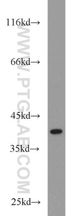 PKA C-alpha Antibody in Western Blot (WB)