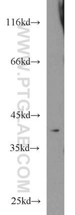 PKA C-alpha Antibody in Western Blot (WB)