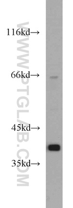 PKA C-alpha Antibody in Western Blot (WB)