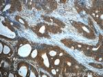 PKA C-alpha Antibody in Immunohistochemistry (Paraffin) (IHC (P))