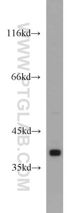PKA C-alpha Antibody in Western Blot (WB)