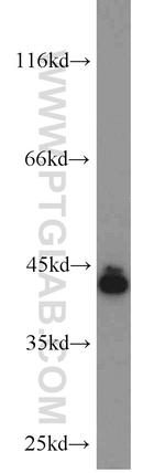 SCARA5 Antibody in Western Blot (WB)