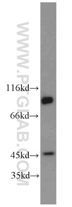 PGAP1 Antibody in Western Blot (WB)