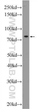 KLHL9 Antibody in Western Blot (WB)
