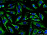 DSPP Antibody in Immunocytochemistry (ICC/IF)