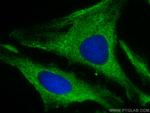 DSPP Antibody in Immunocytochemistry (ICC/IF)