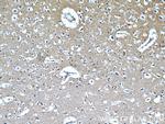 IMPDH2 Antibody in Immunohistochemistry (Paraffin) (IHC (P))