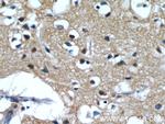 IMPDH2 Antibody in Immunohistochemistry (Paraffin) (IHC (P))