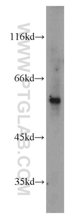 IMPDH2 Antibody in Western Blot (WB)