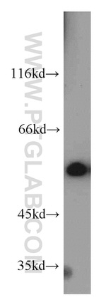 IMPDH2 Antibody in Western Blot (WB)
