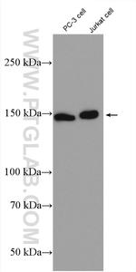 S3-12 Antibody in Western Blot (WB)
