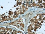 KHSRP Antibody in Immunohistochemistry (Paraffin) (IHC (P))