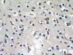 ND5 Antibody in Immunohistochemistry (Paraffin) (IHC (P))