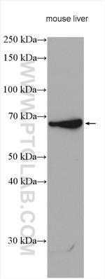 ND5 Antibody in Western Blot (WB)