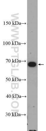 ND5 Antibody in Western Blot (WB)