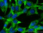 ZFYVE26 Antibody in Immunocytochemistry (ICC/IF)