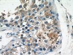 TSN Antibody in Immunohistochemistry (Paraffin) (IHC (P))