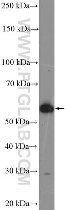 CYP3A7 Antibody in Western Blot (WB)