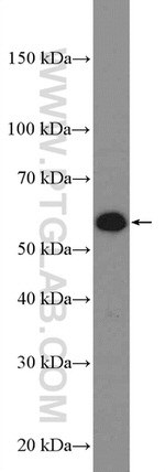 CYP3A7 Antibody in Western Blot (WB)