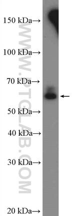 CYP3A7 Antibody in Western Blot (WB)
