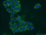 PYGL Antibody in Immunocytochemistry (ICC/IF)