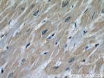 STUB1 Antibody in Immunohistochemistry (Paraffin) (IHC (P))