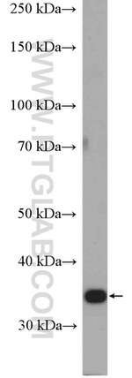 STUB1 Antibody in Western Blot (WB)