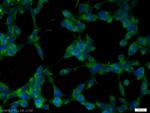 EXOC6B Antibody in Immunocytochemistry (ICC/IF)
