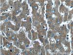 EXOC6B Antibody in Immunohistochemistry (Paraffin) (IHC (P))