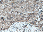 TPM2 Antibody in Immunohistochemistry (Paraffin) (IHC (P))