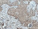 TPM2 Antibody in Immunohistochemistry (Paraffin) (IHC (P))
